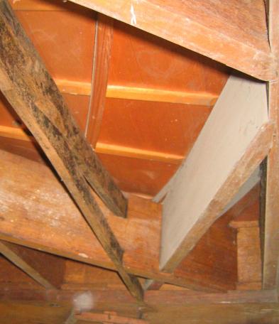 endoskopische Aufnahme: Unterspreize