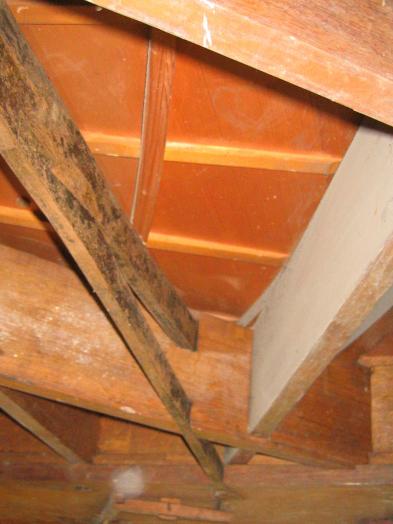 endoskopische Aufnahme: Unterspreize